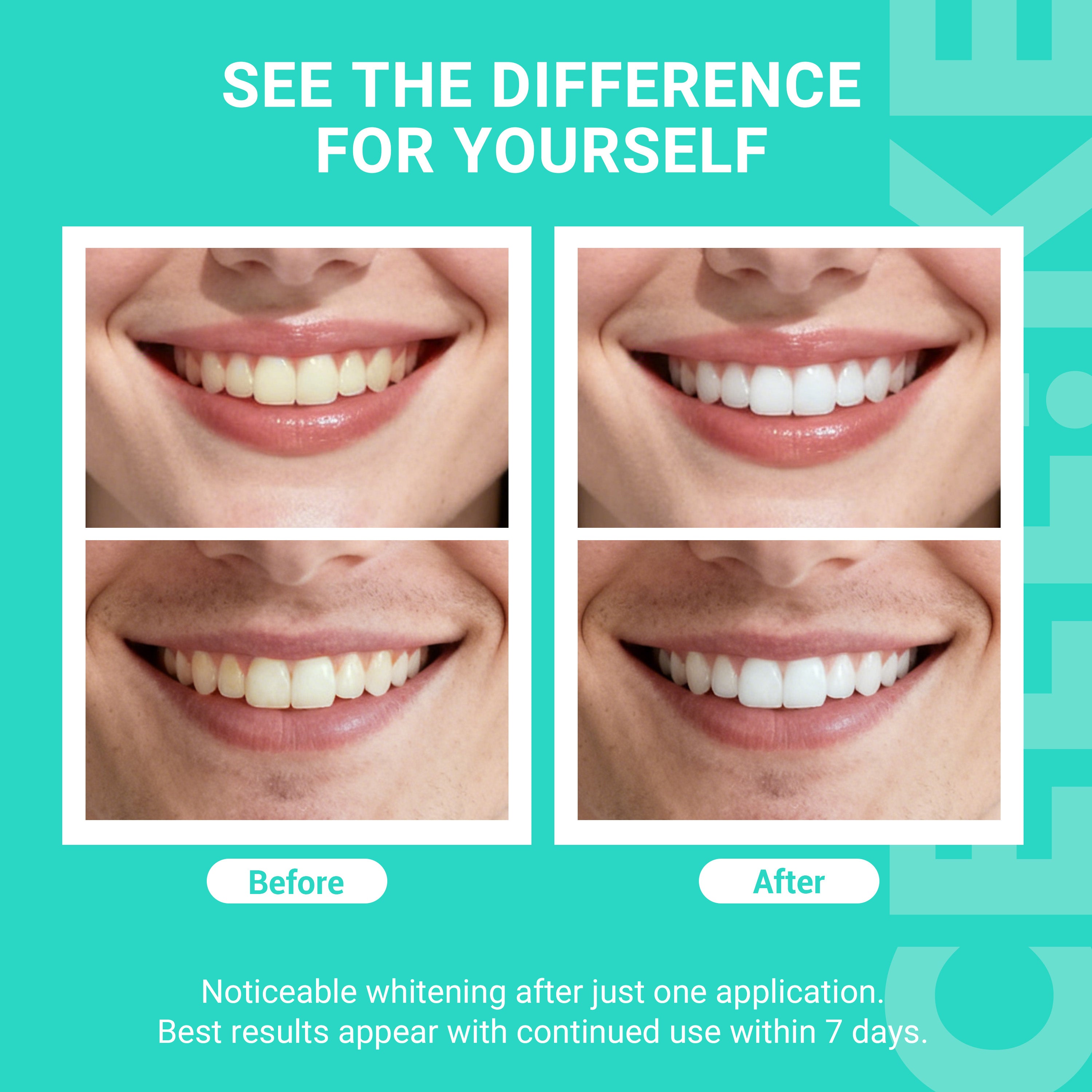 Tiras blanqueadoras dentales profesionales CEELIKE: brillo rápido y duradero para una sonrisa segura